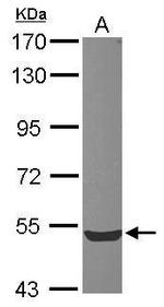 ZWILCH Antibody in Western Blot (WB)