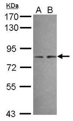 DIP13B Antibody in Western Blot (WB)