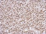 PHF10 Antibody in Immunohistochemistry (Paraffin) (IHC (P))