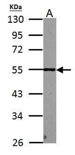 PHF10 Antibody in Western Blot (WB)