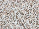 SIN3B Antibody in Immunohistochemistry (Paraffin) (IHC (P))