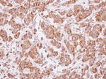 MAGEA4 Antibody in Immunohistochemistry (Paraffin) (IHC (P))