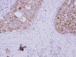 WDSUB1 Antibody in Immunohistochemistry (Paraffin) (IHC (P))