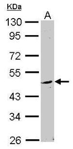 WDSUB1 Antibody in Western Blot (WB)