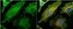 Galectin 1 Antibody in Immunocytochemistry (ICC/IF)