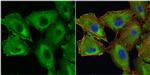 Galectin 1 Antibody in Immunocytochemistry (ICC/IF)