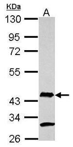 AIM2 Antibody in Western Blot (WB)