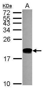 POLE3 Antibody in Western Blot (WB)