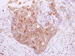 TOLLIP Antibody in Immunohistochemistry (Paraffin) (IHC (P))