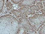 DDX28 Antibody in Immunohistochemistry (Paraffin) (IHC (P))