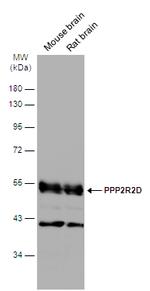 PPP2R2D Antibody in Western Blot (WB)