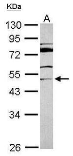 ITFG2 Antibody in Western Blot (WB)