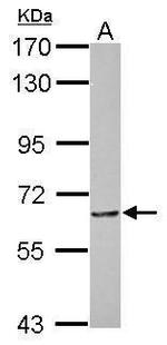 MTA3 Antibody in Western Blot (WB)