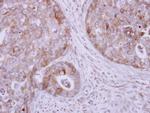 KIF17 Antibody in Immunohistochemistry (Paraffin) (IHC (P))