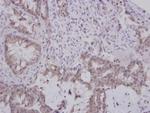 GBA3 Antibody in Immunohistochemistry (Paraffin) (IHC (P))