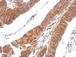 CXCL16 Antibody in Immunohistochemistry (Paraffin) (IHC (P))