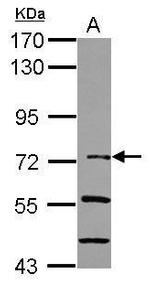 IkB zeta Antibody in Western Blot (WB)