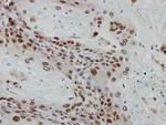 POLR1E Antibody in Immunohistochemistry (Paraffin) (IHC (P))