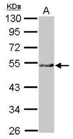 NARFL Antibody in Western Blot (WB)