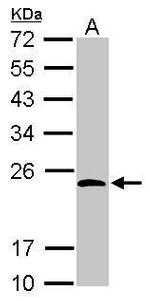 KCTD15 Antibody in Western Blot (WB)