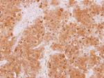 WDR77 Antibody in Immunohistochemistry (Paraffin) (IHC (P))