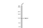 SMC6 Antibody in Western Blot (WB)