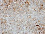 Nectin 4 Antibody in Immunohistochemistry (Paraffin) (IHC (P))