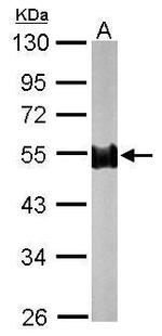 NORE1 Antibody in Western Blot (WB)