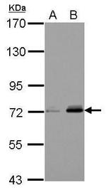 Kindlin 3 Antibody in Western Blot (WB)