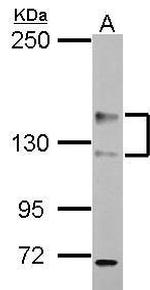 ADAMTS18 Antibody in Western Blot (WB)