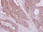 HIP1R Antibody in Immunohistochemistry (Paraffin) (IHC (P))