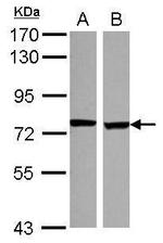 SCNN1D Antibody in Western Blot (WB)