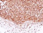 DECR1 Antibody in Immunohistochemistry (Paraffin) (IHC (P))