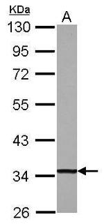 DECR1 Antibody in Western Blot (WB)