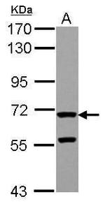 ZP2 Antibody in Western Blot (WB)