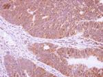 NRBP2 Antibody in Immunohistochemistry (Paraffin) (IHC (P))