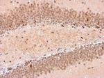 NFIX Antibody in Immunohistochemistry (Paraffin) (IHC (P))