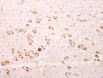 FTMT Antibody in Immunohistochemistry (Paraffin) (IHC (P))