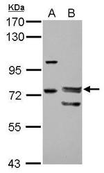 FOXP4 Antibody in Western Blot (WB)