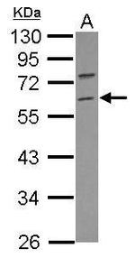 RNF36 Antibody in Western Blot (WB)