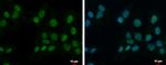 ZNF596 Antibody in Immunocytochemistry (ICC/IF)