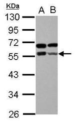 ZBTB9 Antibody in Western Blot (WB)