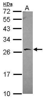 BAG2 Antibody in Western Blot (WB)