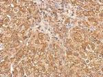 Tankyrase Antibody in Immunohistochemistry (Paraffin) (IHC (P))