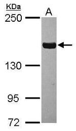 Tankyrase Antibody in Western Blot (WB)