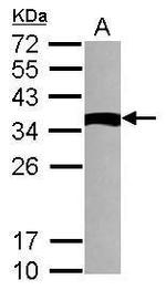 TXNDC6 Antibody in Western Blot (WB)