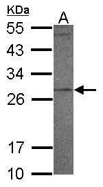 PR3 Antibody in Western Blot (WB)