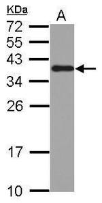 hnRNP A2B1 Antibody in Western Blot (WB)