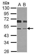 TAPBPL Antibody in Western Blot (WB)