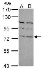 TBR1 Antibody in Western Blot (WB)